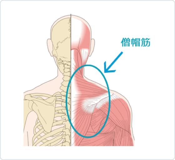 頭痛