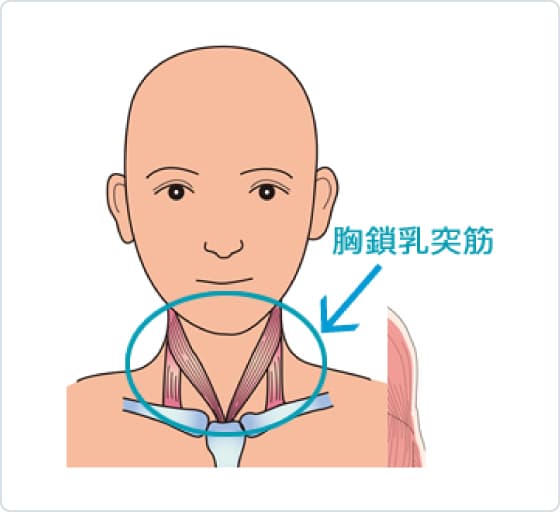 頭痛