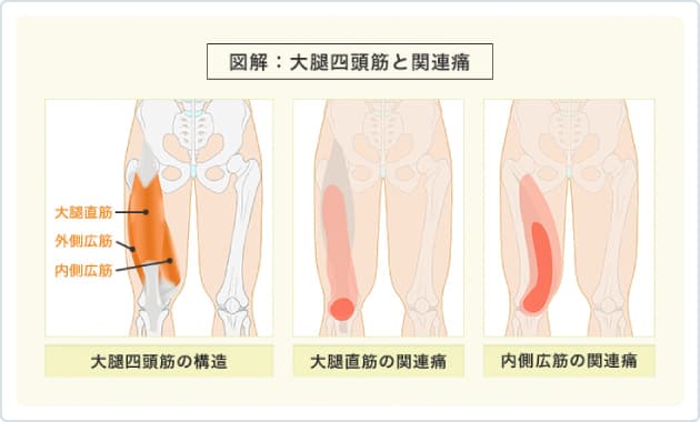 膝痛