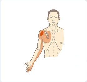 腸腰筋