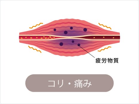 野球肘