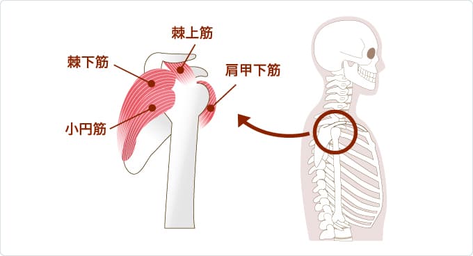 腱板損傷