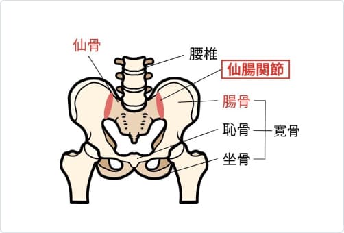 仙腸関節症