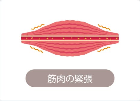 坐骨神経痛