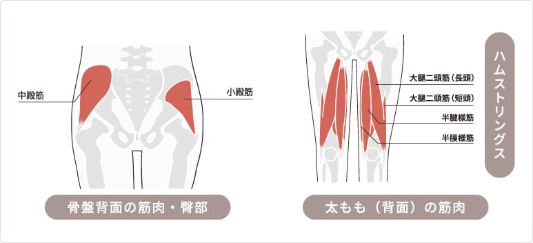 坐骨神経痛