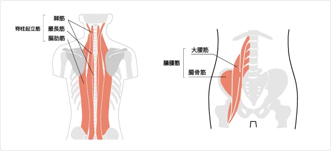 ぎっくり腰