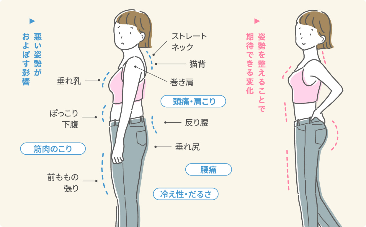 POSTURE CORRECTION THERAPY