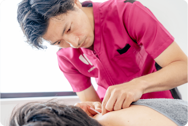 TRIGGER POINT RESET ACUPUNCTURE