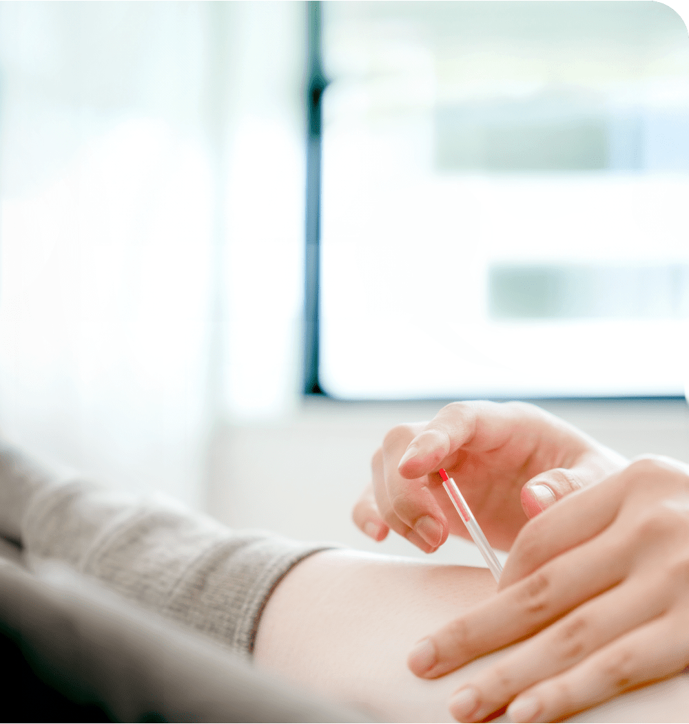 TRIGGER POINT RESET ACUPUNCTURE