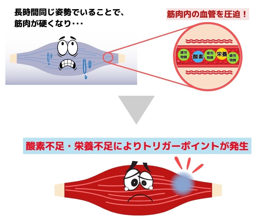 トリガーポイントの仕組み